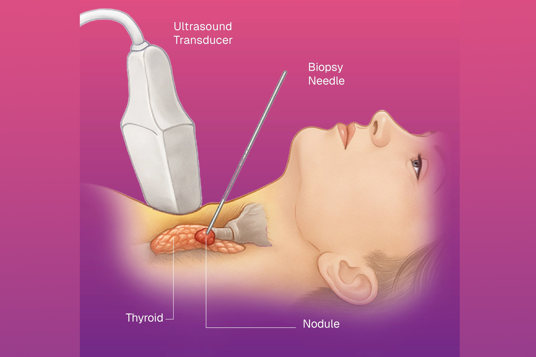 Illustration of FNAC & Biopsy Services