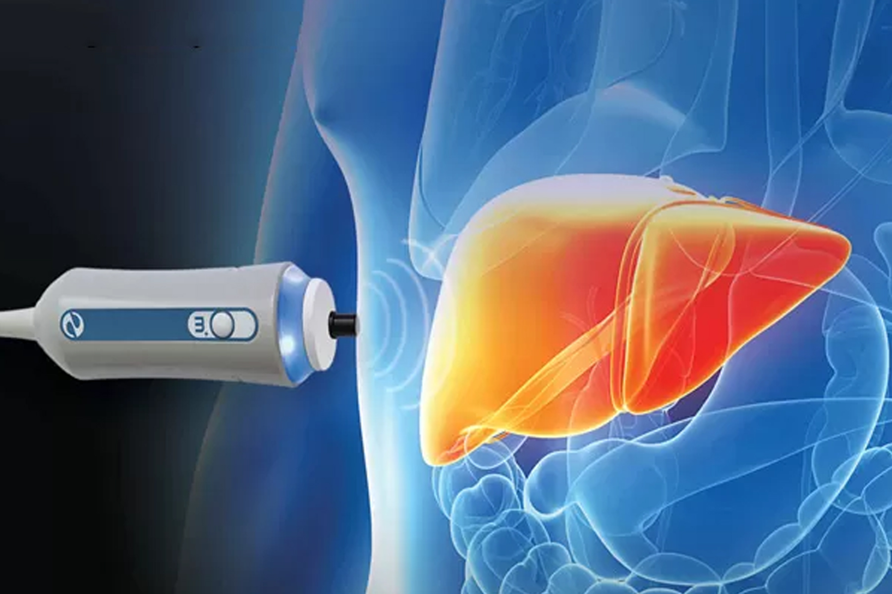 Illustration of Liver FibroScan